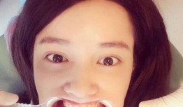 吃瓜娱乐张大奕,吃瓜娱乐界的风云人物